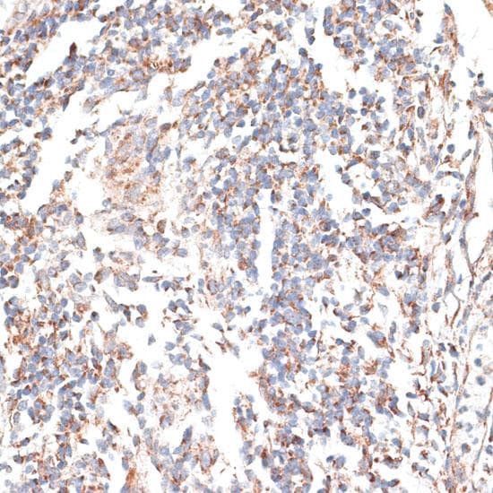 Polyclonal Rabbit anti-Human KATNA1 Antibody (IHC)