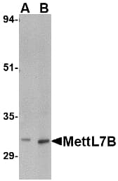 IHC-plus™ METTL7B Antibody