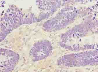 PADI3 Antibody