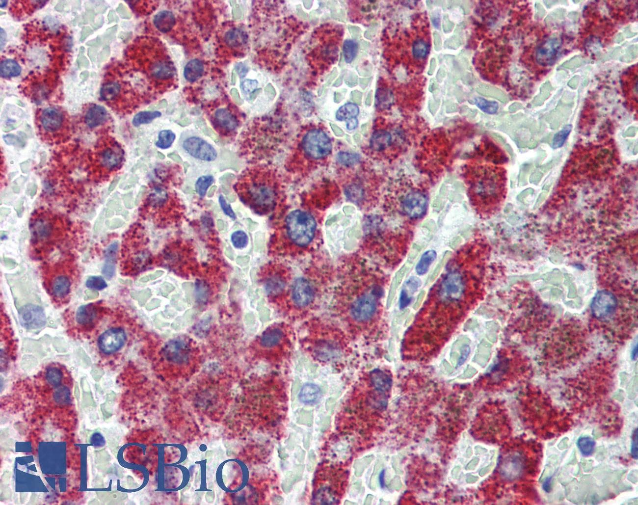 IHC-plus™ SCAD / ACADS Antibody