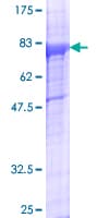Human ZAK / MLTK Protein (Recombinant GST)