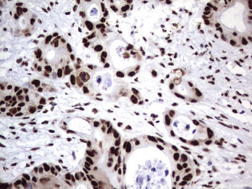 DDX56 Antibody (aa323-547, clone UMAB153, Carrier-free)