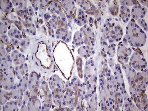 PECAM-1 / CD31 Antibody (clone UMAB164)