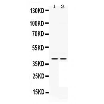 Polyclonal Rabbit anti-Human MAP2K3 / MEK3 / MKK3 Antibody (aa311-347, IHC, WB)