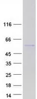 Human PSD3 Protein (Recombinant Myc-DDK (Flag))