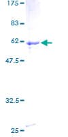 Human ZBTB32 / TZFP Protein (Recombinant GST)