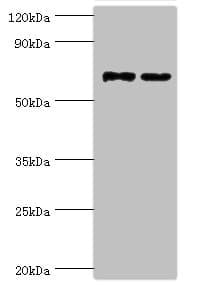 Polyclonal Rabbit anti-Human MTMR14 Antibody (aa1-280, IHC, WB)