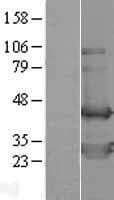 TWF2 / PTK9L Protein (Over-Expression Lysate Myc-DDK (Flag))
