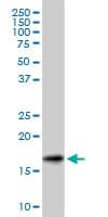 SNCG / Gamma-Synuclein Antibody (clone 2C3)