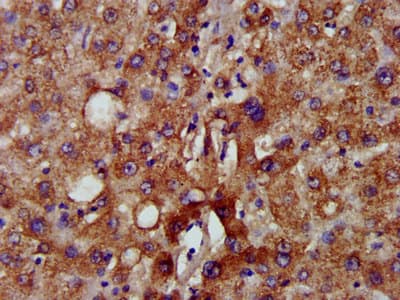 Polyclonal Rabbit anti-Human NADK2 / C5orf33 Antibody (IHC, WB)