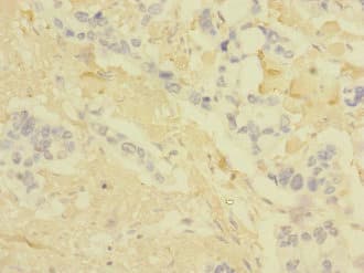 Polyclonal Rabbit anti-Human CLDN18 / Claudin 18 Antibody (IHC, WB)