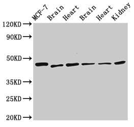 DKC1 / Dyskerin Antibody