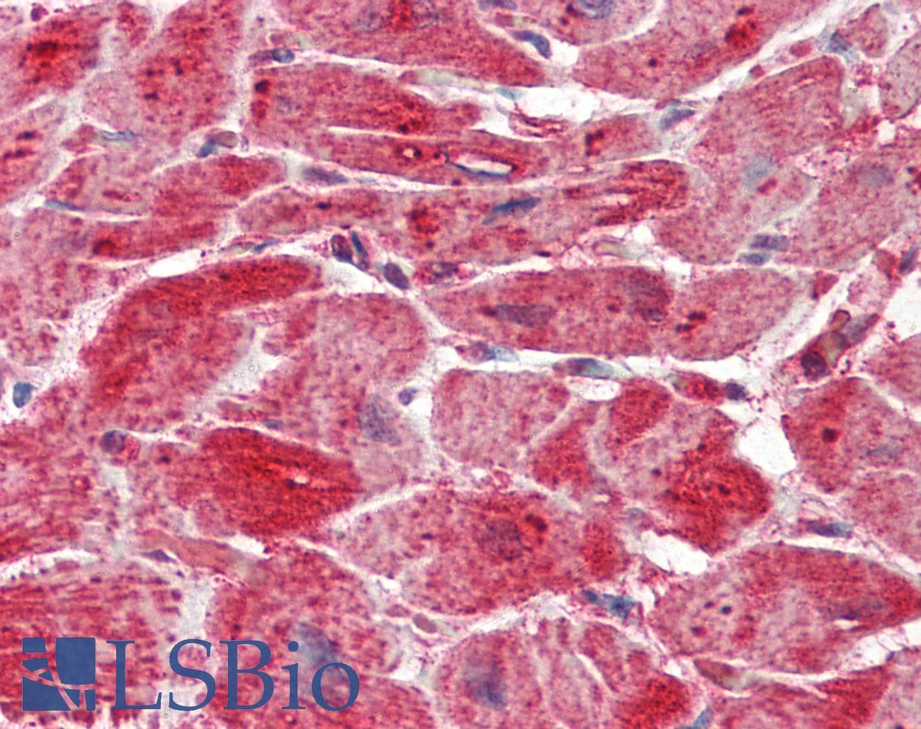 Polyclonal Rabbit anti-Human SLC4A3 / AE3 Antibody (aa36-85, IHC, WB)