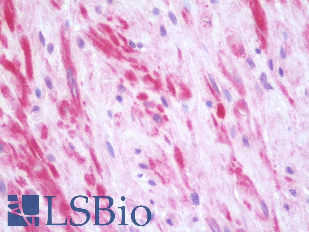PathPlus™ APLNR/ Apelin Receptor / APJ Antibody (Cytoplasmic Domain)