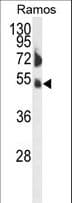 FCRL4 / IRTA1 / CD307d Antibody (aa480-507)