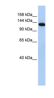 MYBPC2 Antibody (aa36-85)