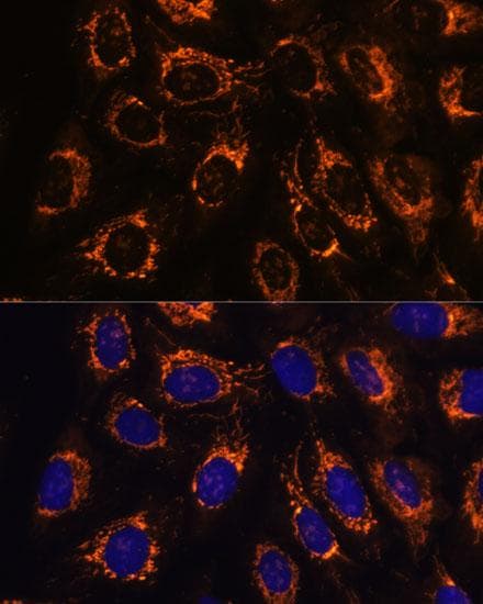 ACAA2 Antibody