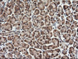 TRMT2A Antibody (clone OTI2C6)
