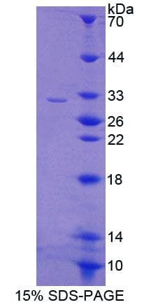 Human CREB5 Protein (Recombinant His-T7, N-terminus)