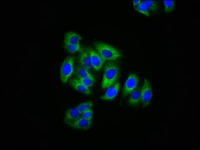 Polyclonal Rabbit anti-Human CCM1 / KRIT1 Antibody (IHC)
