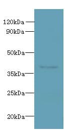 Polyclonal Rabbit anti-Human RSPH14 / RTDR1 Antibody (IHC, WB)