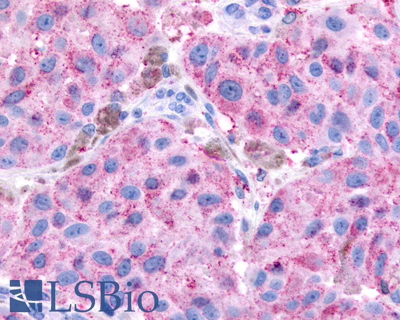 PathPlus™ Polyclonal Rabbit anti-Human GPR65 / TDAG8 Antibody (Cytoplasmic Domain, IHC)