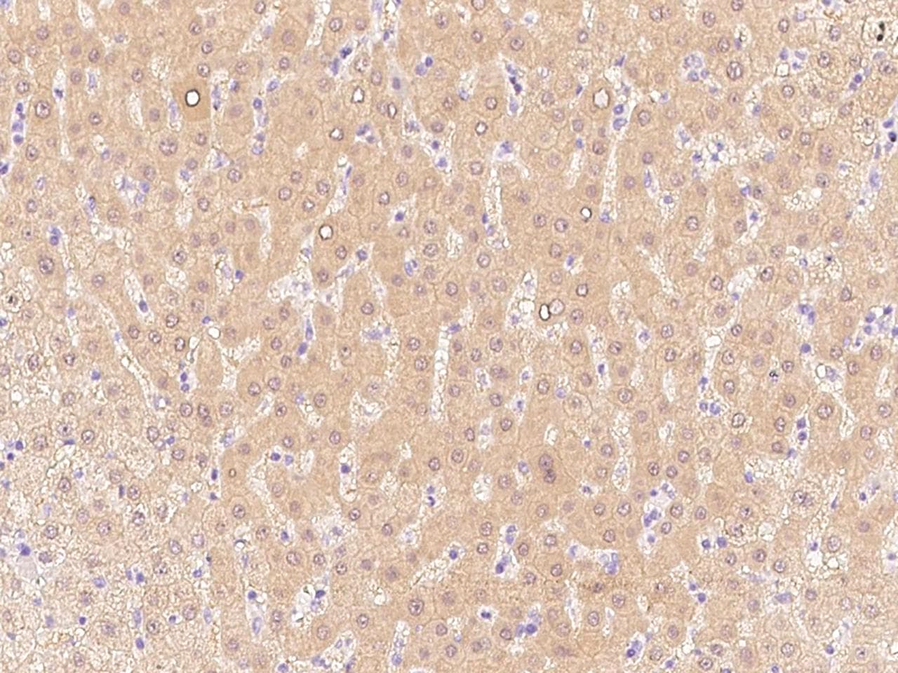 ALDH8A1 Antibody (Preservative Free)