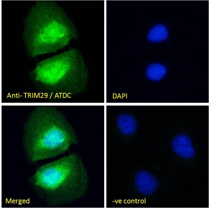 IHC-plus™ TRIM29 Antibody (aa295-306)