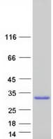 Human DNAJC5B Protein (Recombinant Myc-DDK (Flag))