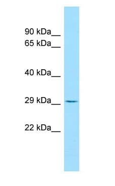 Polyclonal Rabbit anti-Human EFNB3 / Ephrin B3 Antibody (aa176-225, WB)