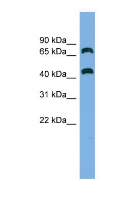 GSPT Antibody (aa395-444)