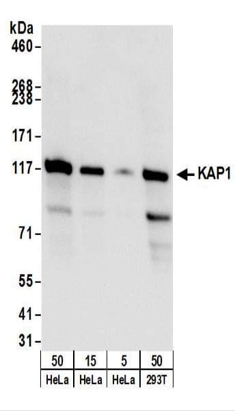 TRIM28 / KAP1 Antibody (aa1-50)