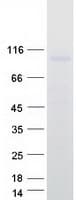 Human TLR2 Protein (Recombinant Myc-DDK (Flag))
