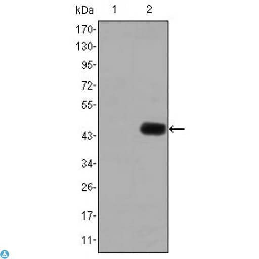 CEACAM5 / CD66e Antibody