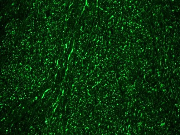 PathPlus™ NEFM / NF-M Antibody (clone RNF406)