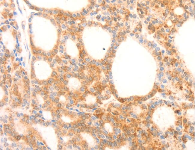 NAP1L1 Antibody
