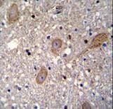 Polyclonal Rabbit anti-Human BTRCP / BETA-TRCP Antibody (aa17-52, IHC, IF, WB)