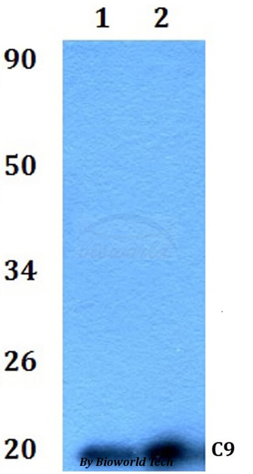 Polyclonal Rabbit anti-Human C9orf89 Antibody (WB)