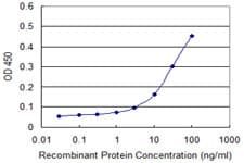 Monoclonal Mouse anti-Human LFNG / Lunatic Fringe Antibody (clone 2D10-3C11, IF, WB)