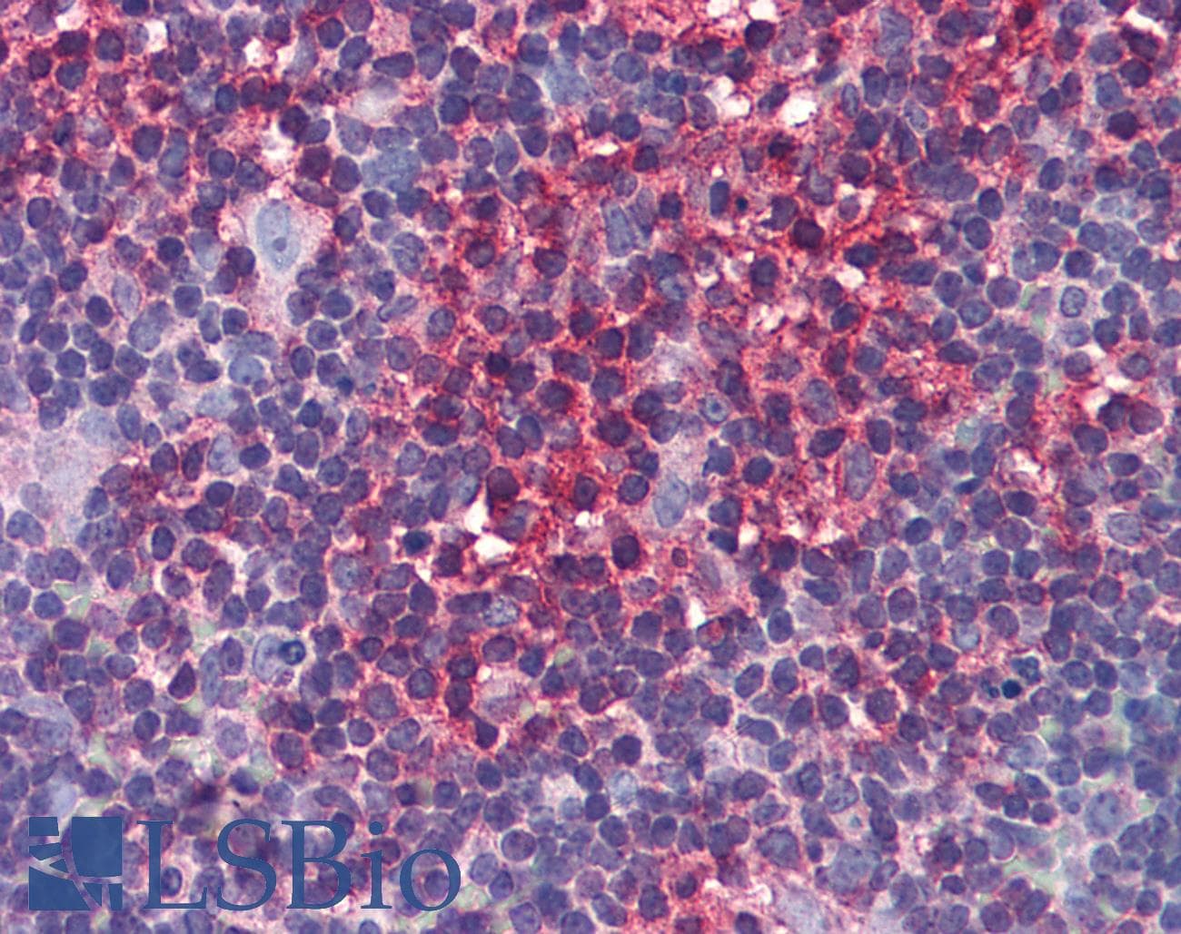 IHC-plus™ ARRB2 / Beta Arrestin 2 Antibody (clone 3G1)