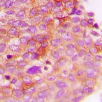 Polyclonal Rabbit anti-Human IRS1 Antibody (phospho-Ser307, IHC, WB)