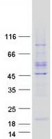 Human YPEL4 Protein (Recombinant Myc-DDK (Flag))