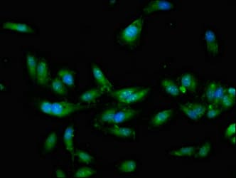 Polyclonal Rabbit anti-Human CRTC2 / TORC2 Antibody (IHC, IF)