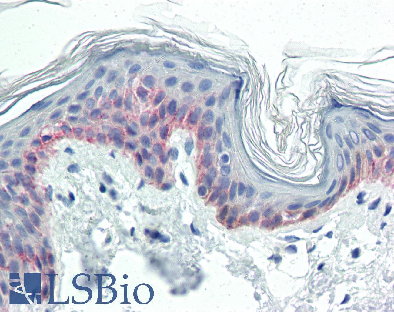 IHC-plus™ KRT5 / CK5 / Cytokeratin 5 Antibody (clone 3E2F1)