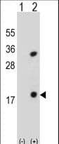 PLA2G1B Antibody (aa116-145)