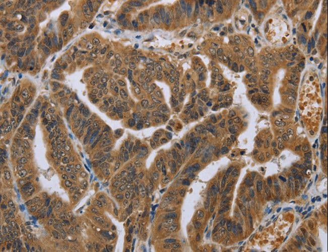 NOD8 / NLRP10 Antibody