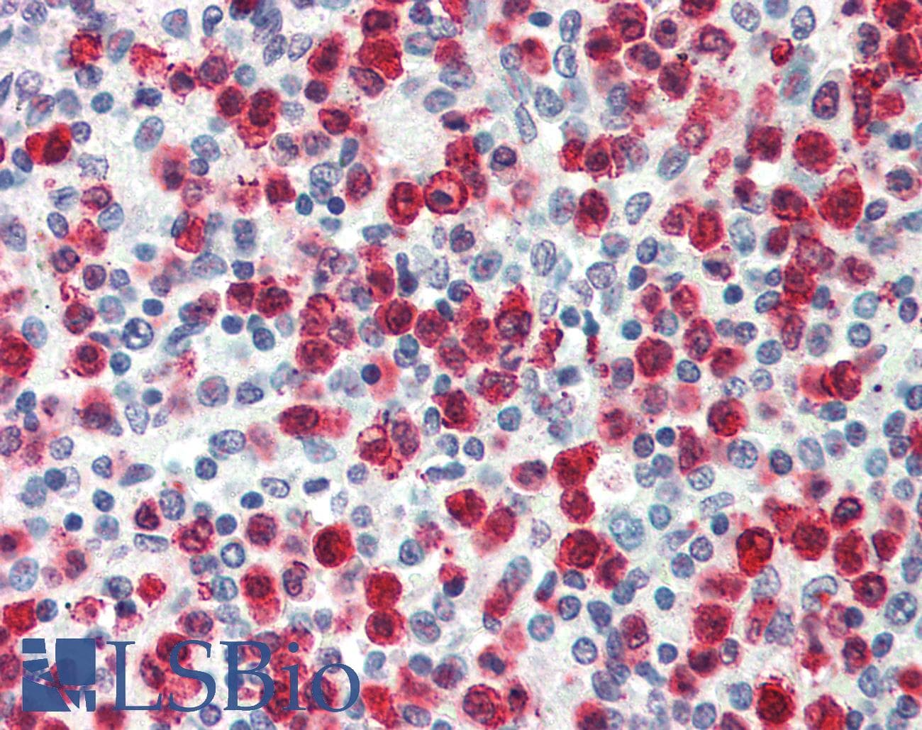 IHC-plus™ Polyclonal Rabbit anti-Human CARD8 / Cardinal / TUCAN Antibody (IHC, IF, WB)
