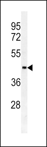 SULT2B1 / Sulfotransferase 2B1 Antibody (aa1-30)