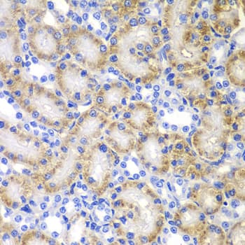 RARB / RAR Beta Antibody