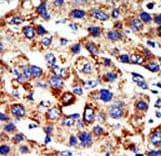HDAC8 Antibody (aa1-30)